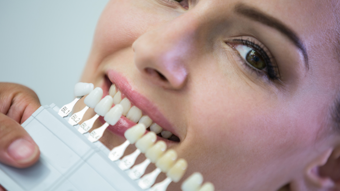 Implantes dentales en Valencia con garantía de por vida: todo lo que debes saber