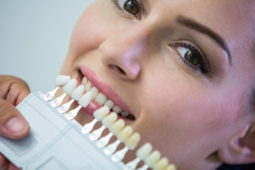 Implantes dentales en Valencia con garantía de por vida: todo lo que debes saber